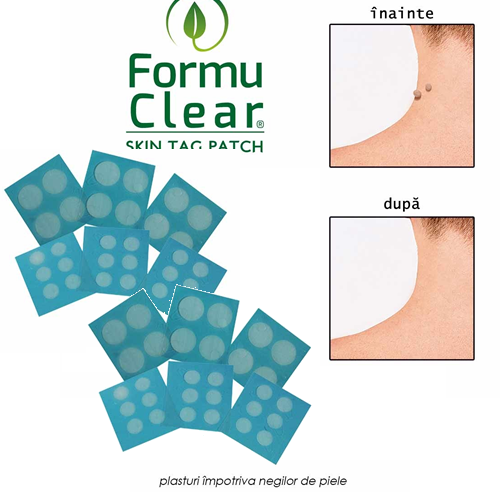 FormuClear - 2  seturi de plasturi